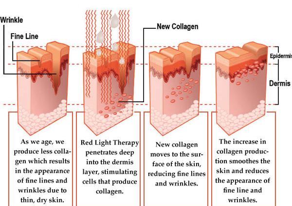 Does Red Light Therapy Work for Weight Loss?